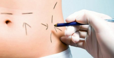 plastic surgery consultant uk